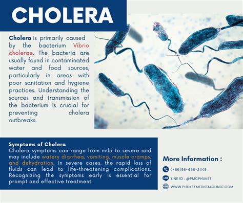 Cholera Causes Symptoms Treatment And Prevention Phuket Medical Clinic