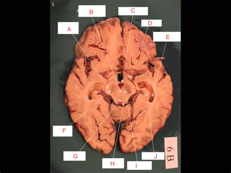 Neuroanatomy Lab 1 Diagram Quizlet