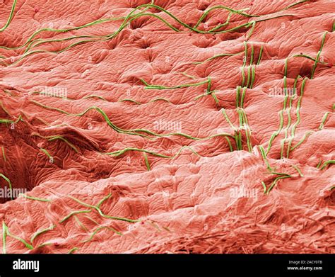 Microsporum Canis Infection Coloured Environmental Scanning Electron Micrograph Esem The