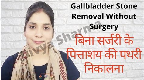 Gallbladder Stone Removal Without Surgeryपित्ताशय की पथरी का इलाजhow