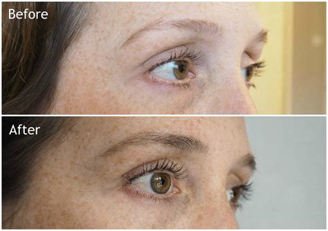 My Rapidlash And Rapidbrow Experience Before And After Melissa Jane Lee