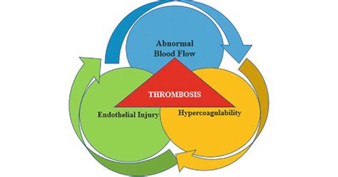 Mechanisms of Virchow Triad in the Pathophysiology of Thrombus ...