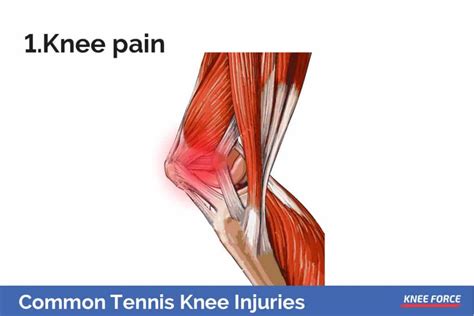 Common Tennis Knee Injuries And How To Prevent Them | Knee Force