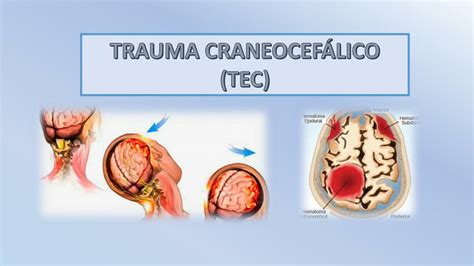 Tec Y Trauma Abdominal