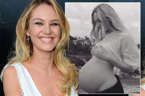 Supermodel Candice Swanepoel Speaks Out After Being Shamed For