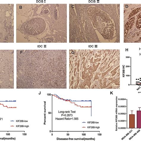 Elk1 And Kif26b Expression In Human Bc Tissues A B Ihc Was Used To