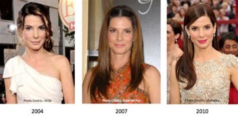 Sandra Bullock Turned 50 Plastic Surgery To Stay Young Celeblenscom