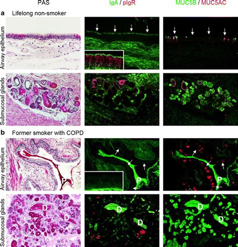 Relationship Of Mucus Dysfunction And Surface Siga Deficiency In Large