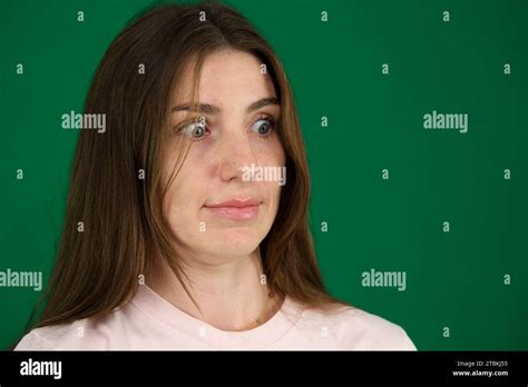 Macro Closeup Of Young Woman Face With Graves Disease Hyperthyroidism