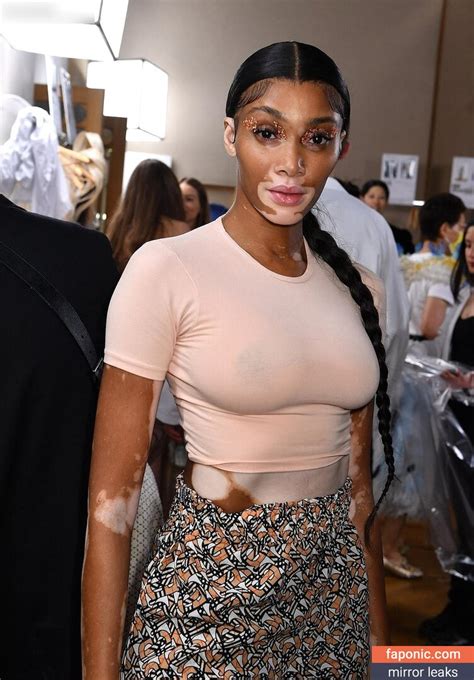 Winnie Harlow Aka Winnieharlow Nude Leaks Photo 139 Faponic