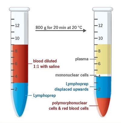 Lymphoprep Serumwerk Bernburg AG 山进生物