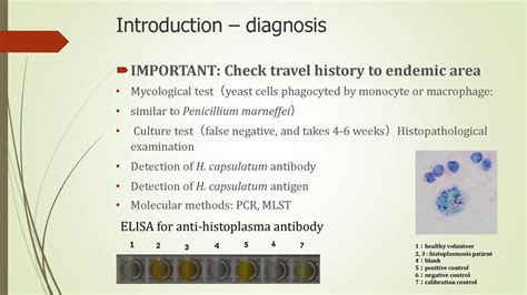 Histoplasmosis Laboratory Diagnosis In Vietnam Ppt Download