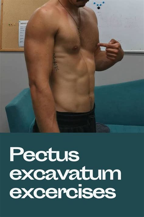 5 Of The Best Exercises To Improve Your Pectus Excavatum Pectus