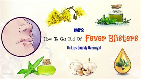 18 Ways How To Get Rid Of Fever Blisters On Lips Overnight