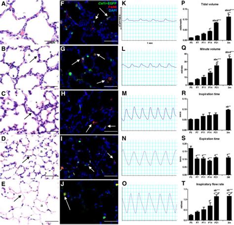 Postnatal Structural And Functional Lung Maturation In The Mouse