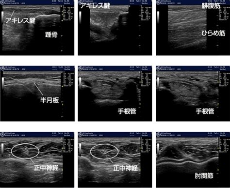 超音波検査について ならやまと整形外科 スポーツクリニック