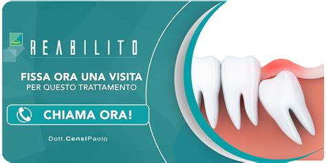 Trattamento Denti Inclusi Anzola Dell Emilia Bologna Dentista