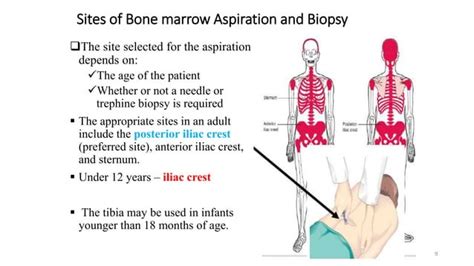 Bone Marrow Aspiration Pptx