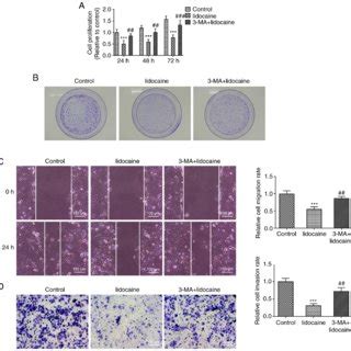 Lidocaine Inhibits Endometrial Cancer Cell Proliferation And Migration