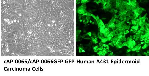 Gfp Expressing Human A Epidermoid Carcinoma Cells Angio Proteomie