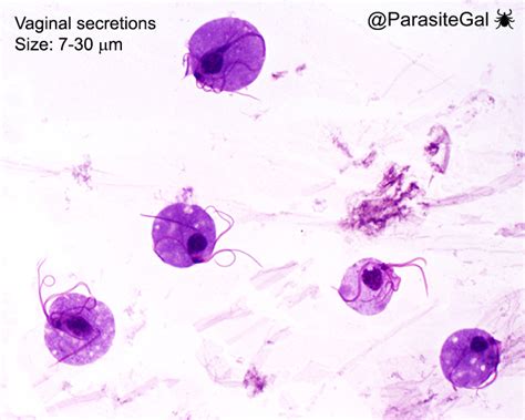 Trichomonas Vaginalis Trophozoites