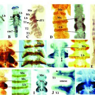 Pdf Evolution Of The Insect Body Plan As Revealed By The Sex Combs