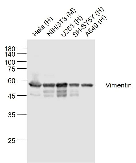 Vimentin Polyclonal Antibody Bioss