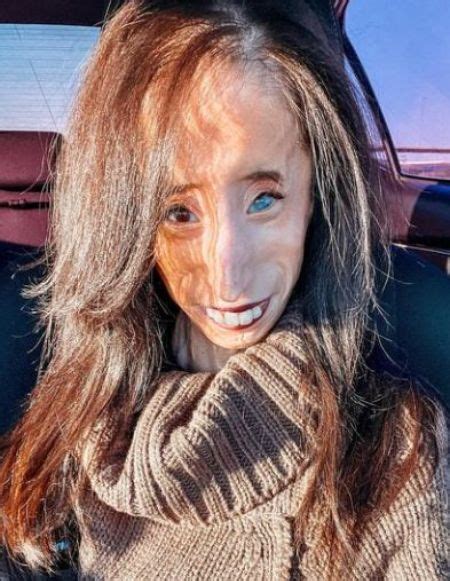 Lizzie Velasquez Married