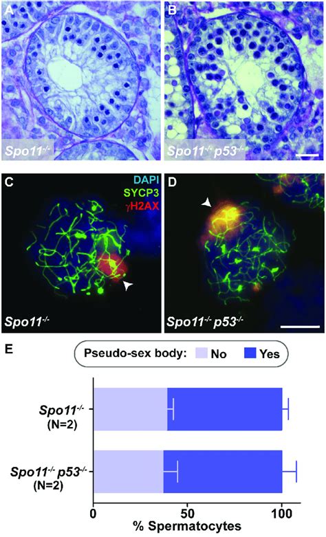 Mutation Of P53 Does Not Rescue Spo11 Meiotic Arrest A B