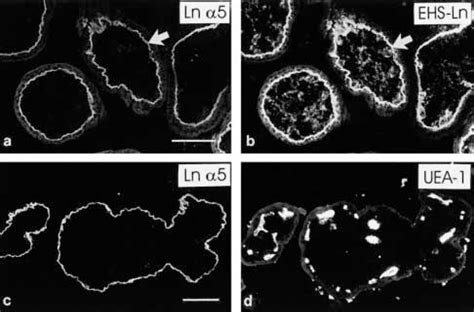 Laminin 5 Chain In First Trimester Placental Villi A B Whereas