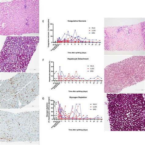 Histopathology Analysis Of Liver Core Biopsies Taken Throughout