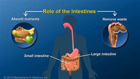 Slide Show What Is An Ileostomy