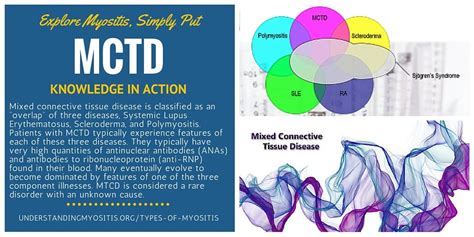 Pin On Mixed Connective Tissue Disorder