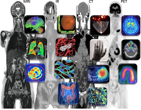 spectrum  medical imaging    international year  light