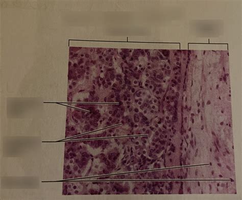 LAB pituitary histology Diagram | Quizlet