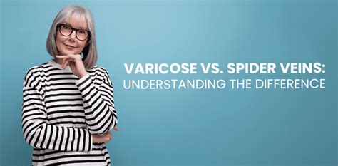 Varicose Vs Spider Veins Understanding The Differences Premier Vascular And Vein Center