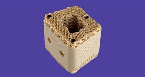 3d Printed Porous Peek Pioneers Reach Spine Market Bonezone