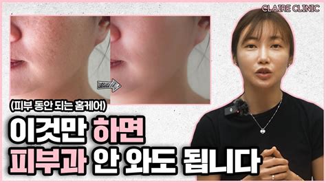 청담동 피부과 의사도 꼭 지키는 피부 좋아지는 습관 3가지 Youtube