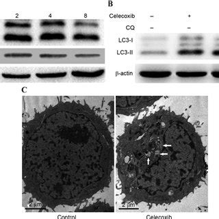 Celecoxibinduced Autophagy In Prostate Cancer PC3 Cells A PC3 Cells