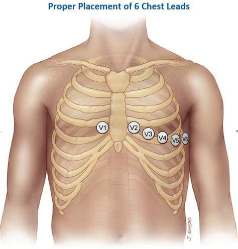 Ecg Learning Center An Introduction To Clinical Electrocardiography