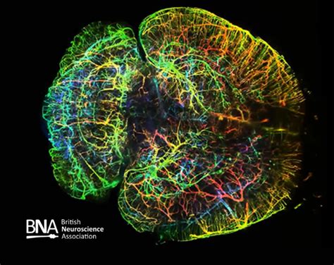 D Imaging Of Entire Brains With Light Sheet Microscopy