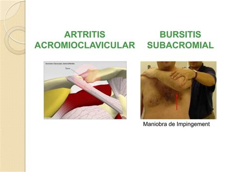 Exploración Física En Reumatología Ppt