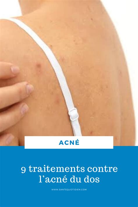 Traitements Contre Lacn Du Dos Acn Acne Dos Comment Enlever