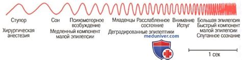 Мозговые волны и уровни активности мозга. Электроэнцефалограмма (ЭЭГ) сна