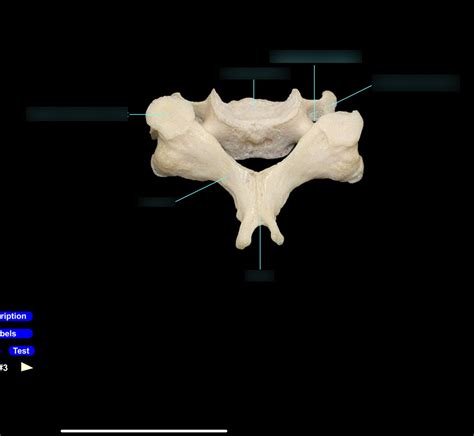 Cervical Vertebrae Diagram Quizlet