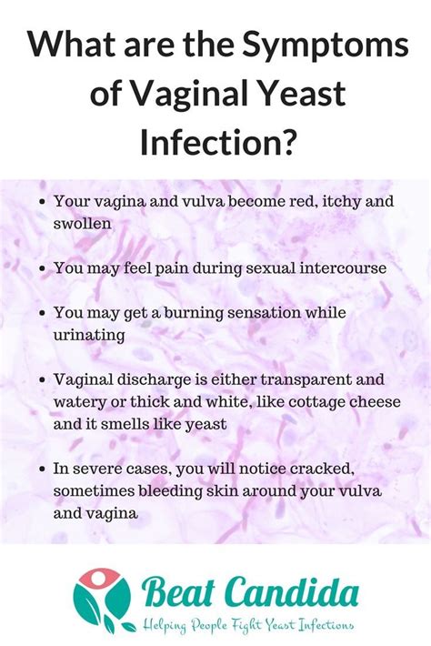 Find Out What Are The Most Common Symptoms And Causes Of Yeast Infection In Women Yeast