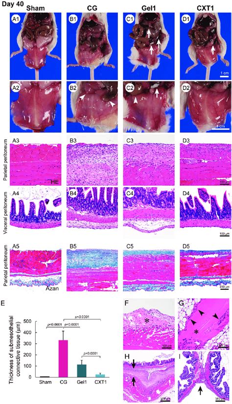 Visceral Peritoneum Histology