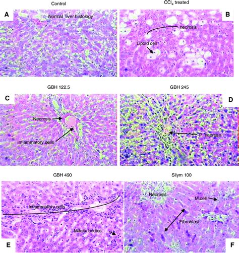 Effect Of Gbh Extract On Liver Histopathology A Normal Liver Tissue