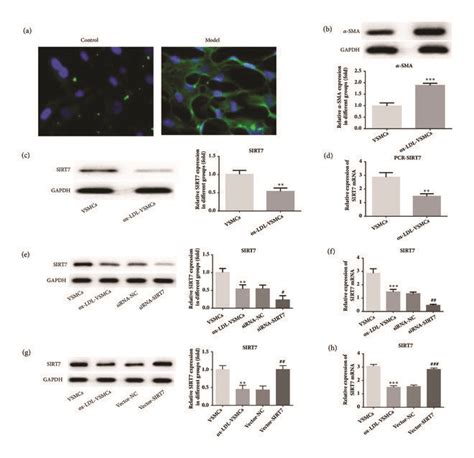 The Sma And Sirt Expression In Ox Ldl Treated Havsmcs A