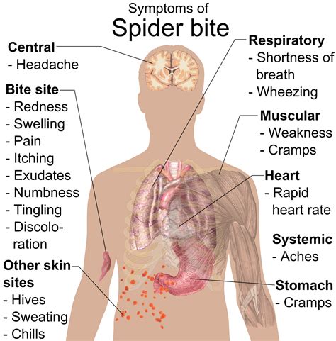 Hobo Spider Bite Symptoms And Preventive Measures Charlies